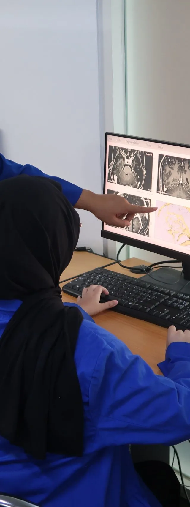 Dosen Udinus Ciptakan Model 3D Pembuluh Darah Otak untuk Tingkatkan Akurasi Bedah Saraf